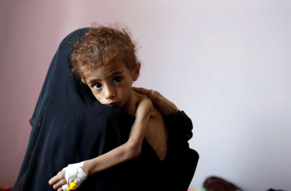 Calls for end to Yemen war offer little hope for hungry children