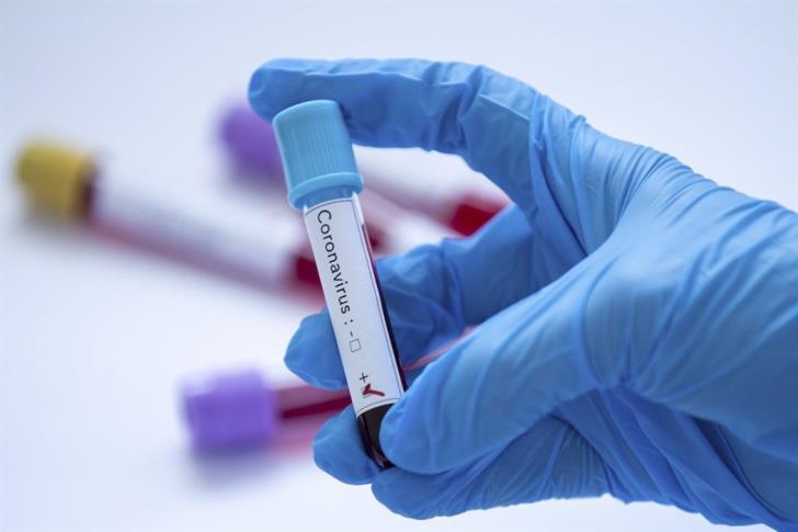 U.S. FDA approves first rapid coronavirus test with 45 minutes detection time
