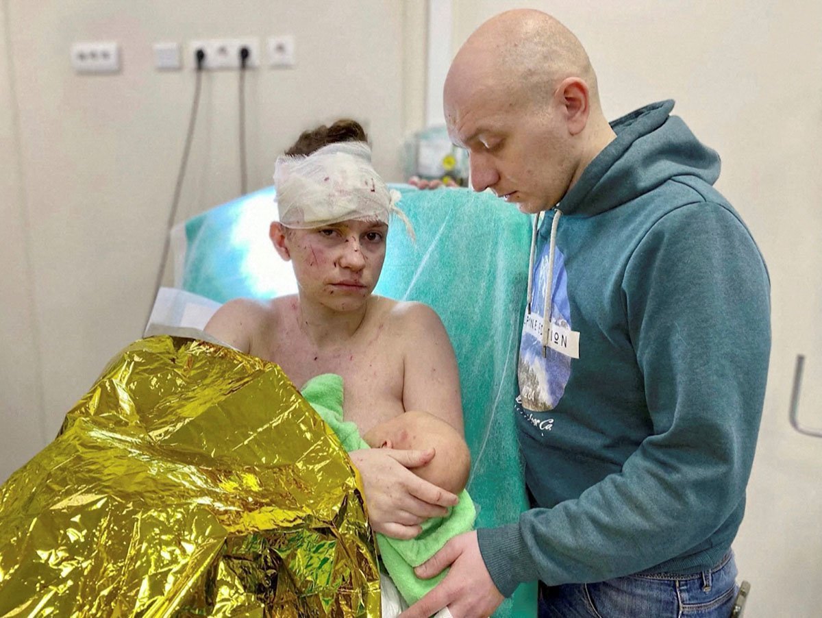 Olga, A 27 Year Old Ukrainian Woman Seriously Wounded While Sheltering Her Baby From Shrapnel Blasts Amid Russia's Ongoing Invasion Of Ukraine, Holds Her Baby Victoria As Her Husband Dmytro Stands By Her Side In Kyiv