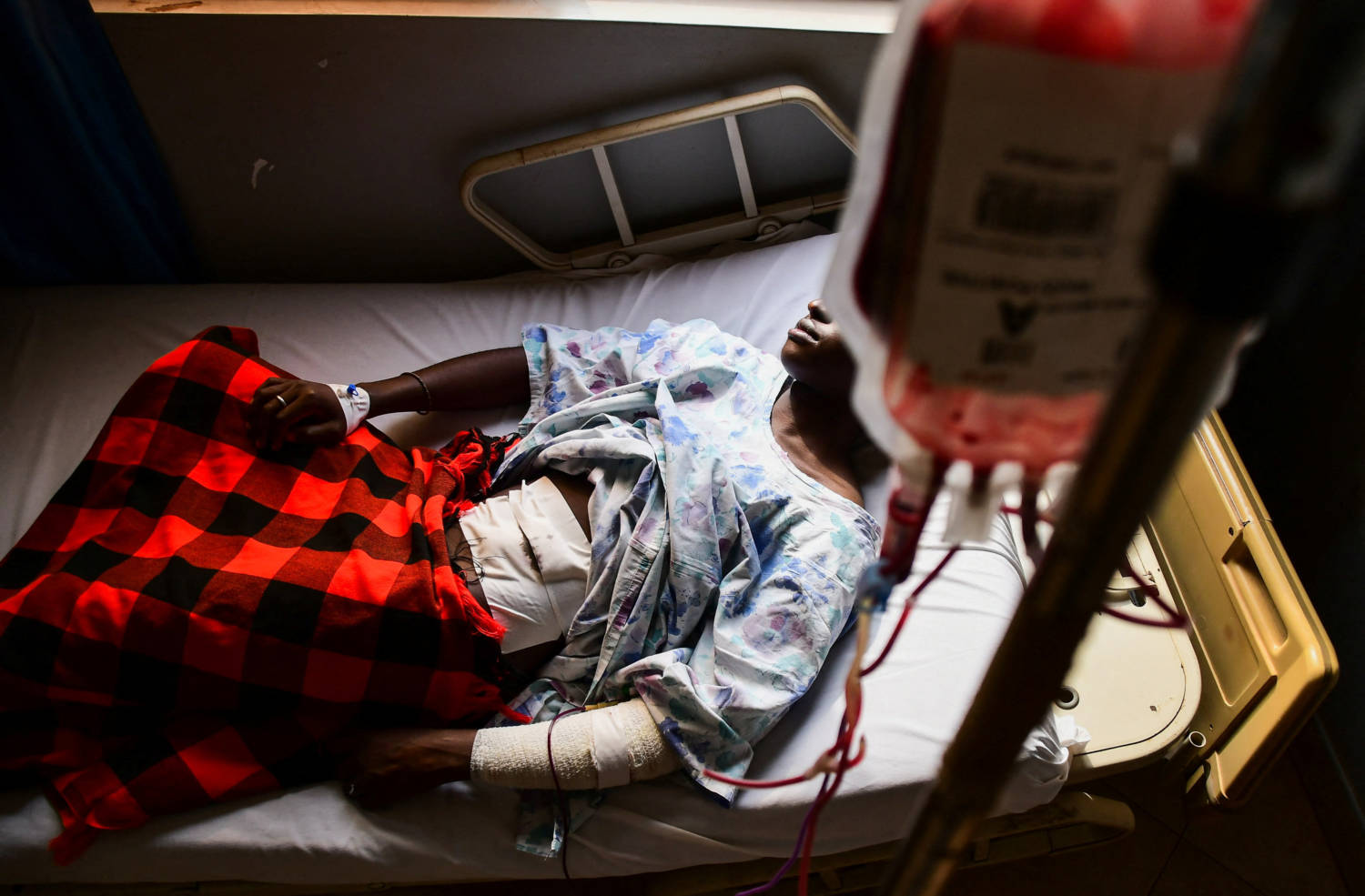 Ugandan Lgbtq Activist Steven Kabuye Receives Treatment After He Was Stabbed By Unknown People, At A Hospital In Kitende Along Entebbe Road On The Outskirts Of Kampala